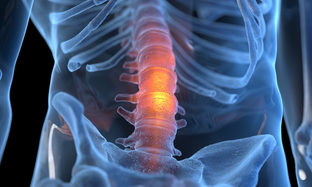Philadelphia Failure To Diagnose Spinal Infection Lawyer