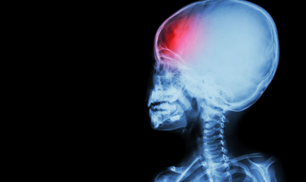 Philadelphia Baby Brain Injury Lawyer