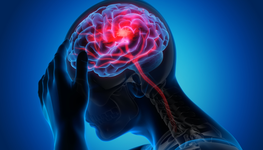 Philadelphia Failure to Diagnose Brain Injury Lawyer
