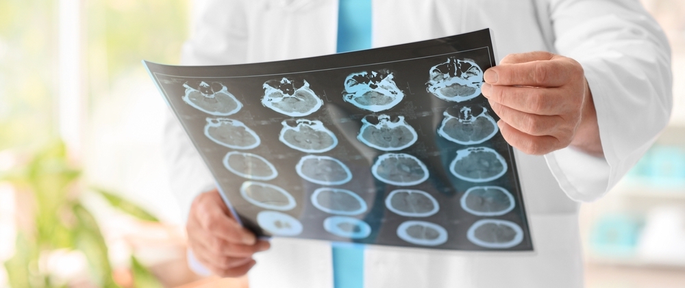 Philadelphia Neurologist Negligence Lawyer